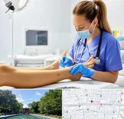 کارشناس زخم در هشت بهشت اصفهان 