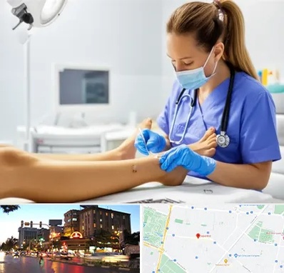 کارشناس زخم در بلوار سجاد مشهد 