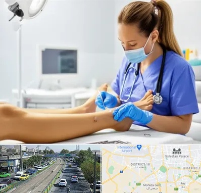 کارشناس زخم در جنوب تهران 