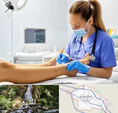 کارشناس زخم در الیگودرز