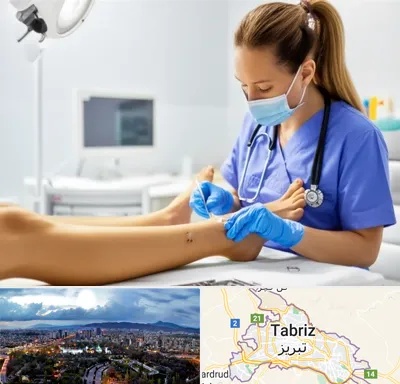 کارشناس زخم در تبریز