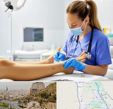 کارشناس زخم در فرهنگ شهر شیراز 