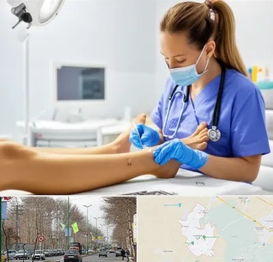 کارشناس زخم در نظرآباد کرج 