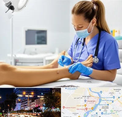 کارشناس زخم در کیانپارس اهواز 