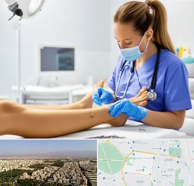 کارشناس زخم در نازی آباد 