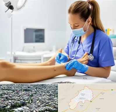 کارشناس زخم در شاهرود