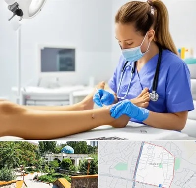 کارشناس زخم در باغمیشه تبریز 