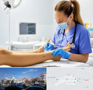 کارشناس زخم در ماهدشت کرج 