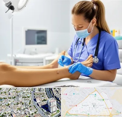 کارشناس زخم در قاسم آباد مشهد 