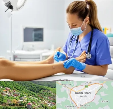 کارشناس زخم در قائم شهر