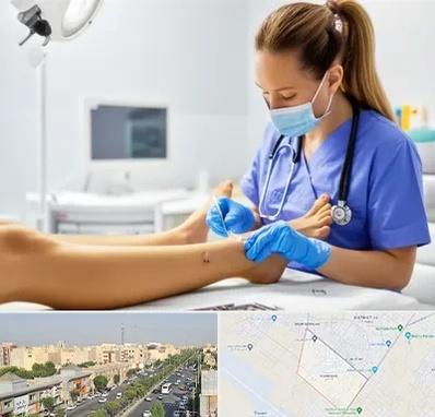 کارشناس زخم در کیانمهر کرج 