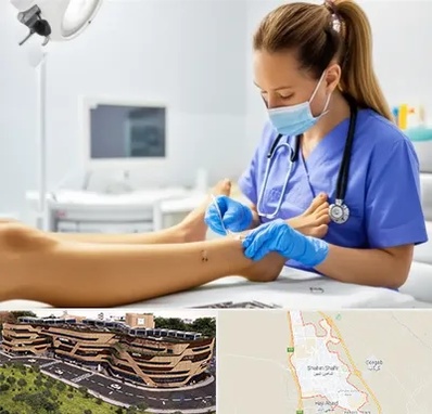 کارشناس زخم در شاهین شهر