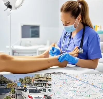 کارشناس زخم در مفتح مشهد 