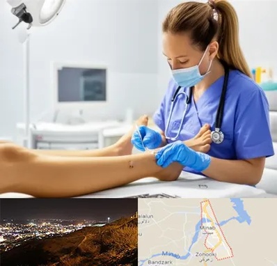 کارشناس زخم در میناب