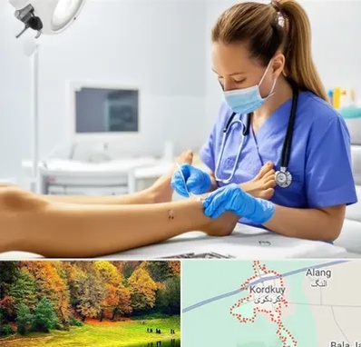 کارشناس زخم در کردکوی