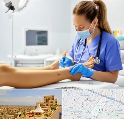 کارشناس زخم در هاشمیه مشهد 