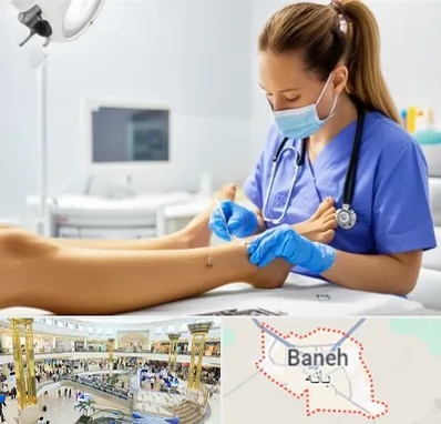 کارشناس زخم در بانه