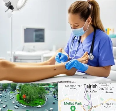 کارشناس زخم در تجریش 