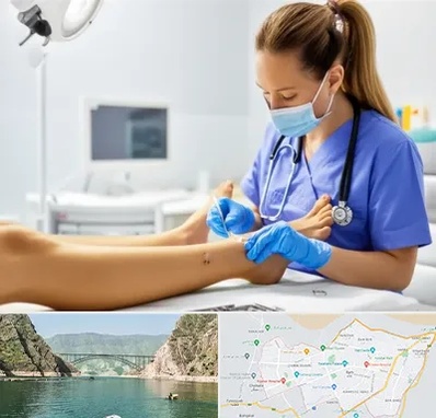 کارشناس زخم در ایلام