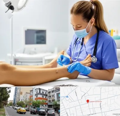 کارشناس زخم در هفده شهریور تبریز 