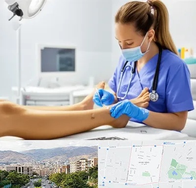 کارشناس زخم در خانی آباد 