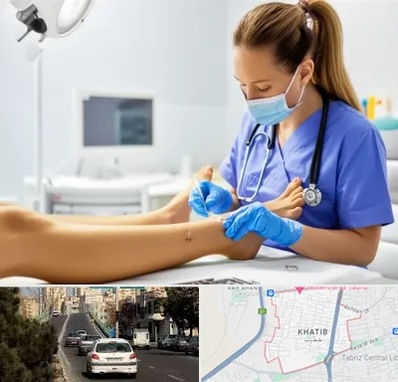 کارشناس زخم در خطیب تبریز 