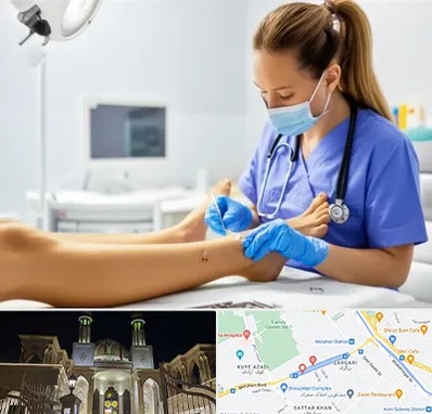 کارشناس زخم در زرگری شیراز 