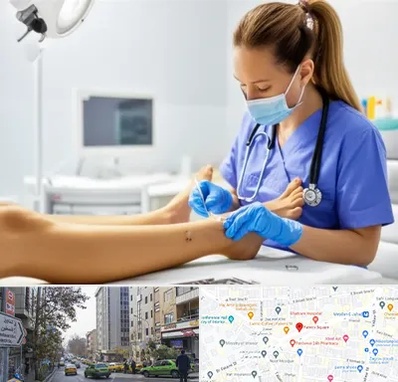 کارشناس زخم در فاطمی