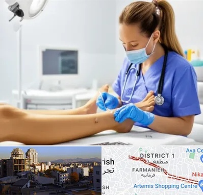 کارشناس زخم در فرمانیه 