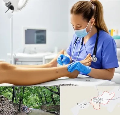 کارشناس زخم در شاندیز مشهد 