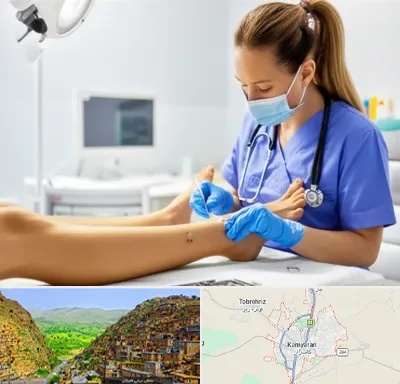 کارشناس زخم در کامیاران