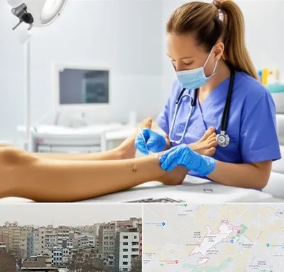 کارشناس زخم در محمد شهر کرج 