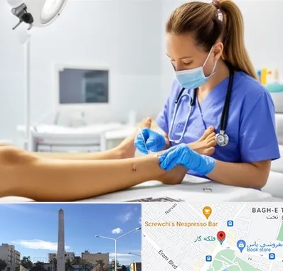 کارشناس زخم در فلکه گاز شیراز 