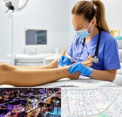 کارشناس زخم در منظریه رشت 