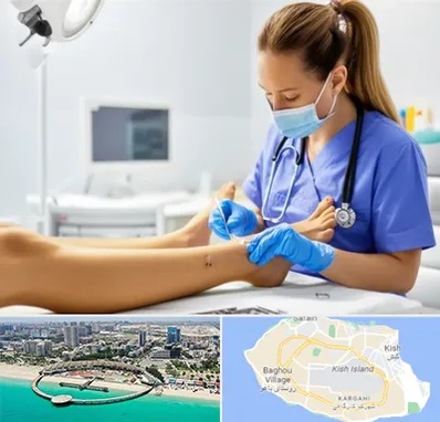 کارشناس زخم در کیش