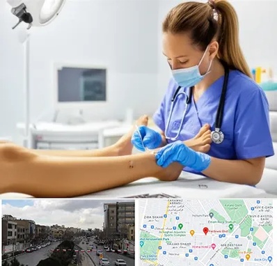 کارشناس زخم در بلوار فردوسی مشهد 