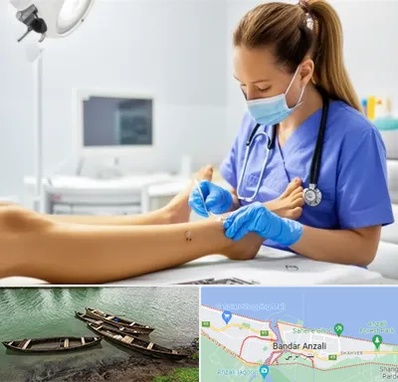 کارشناس زخم در بندر انزلی