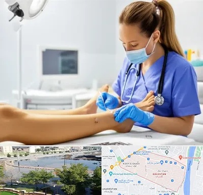 کارشناس زخم در گلستان اهواز 