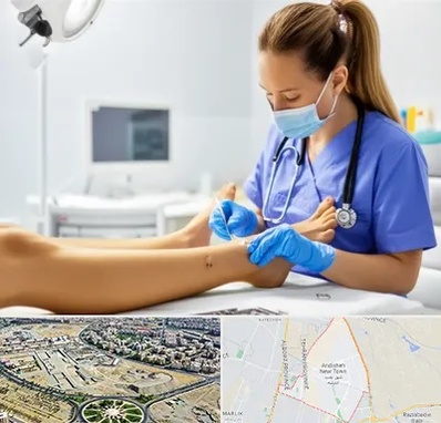 کارشناس زخم در اندیشه