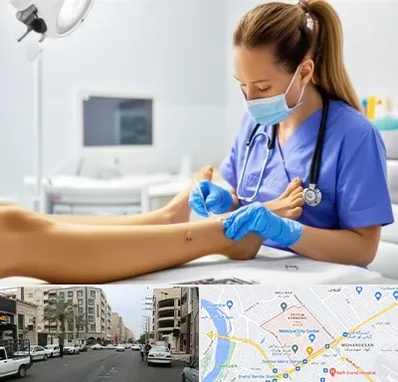 کارشناس زخم در زیتون کارمندی اهواز 