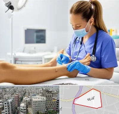 کارشناس زخم در آذری