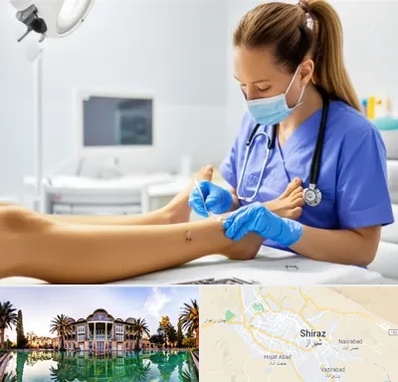 کارشناس زخم در شیراز