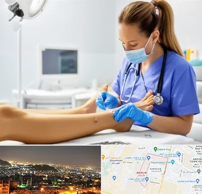 کارشناس زخم در مارلیک کرج 