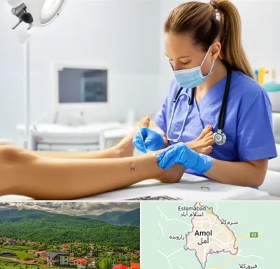 کارشناس زخم در آمل