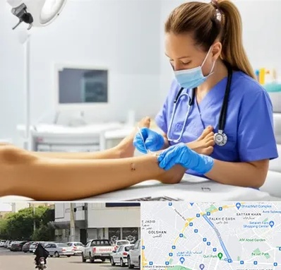 کارشناس زخم در قدوسی شرقی شیراز 