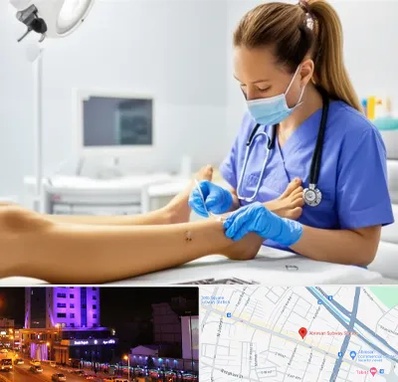 کارشناس زخم در آبرسان تبریز 