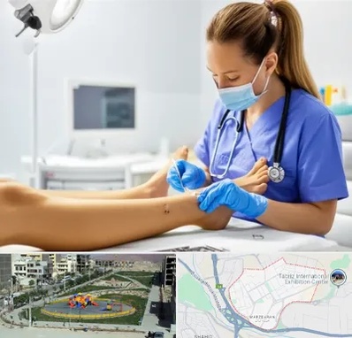 کارشناس زخم در مرزداران تبریز 