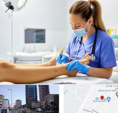 کارشناس زخم در چهارراه طالقانی کرج 