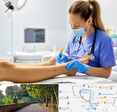 کارشناس زخم در بلوار گیلان رشت 