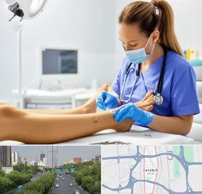 کارشناس زخم در توانیر
